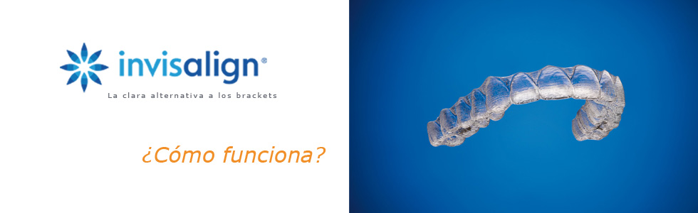 Cómo funciona Invisalign - Clínica dental Costa Codina - Centro de odontología general en Granollers