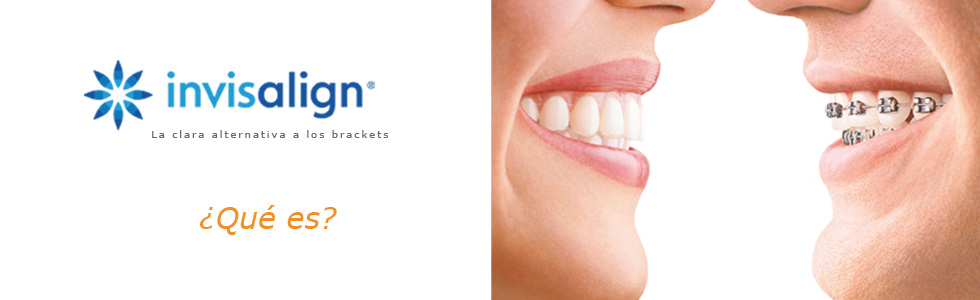 Qué es Invisalign - Clínica dental Costa Codina - Centro de odontología general en Granollers