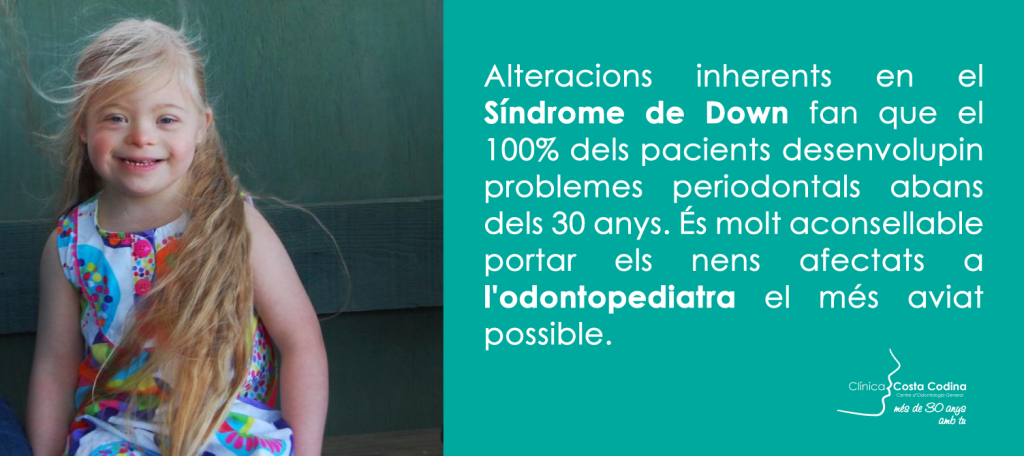 El Síndrome de Down i la salud periodontal