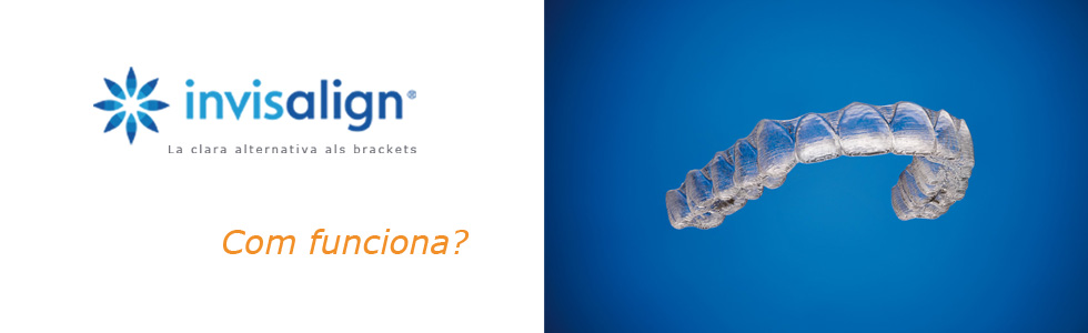 Com funciona Invisalign - Clínica dental Costa Codina - Centre d'odontologia general a Granollers Com funciona Invisalign - Clínica dental Costa Codina - Centre d'odontologia general a Granollers